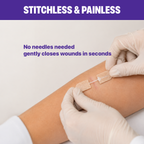 Wound Skin Closure Kit