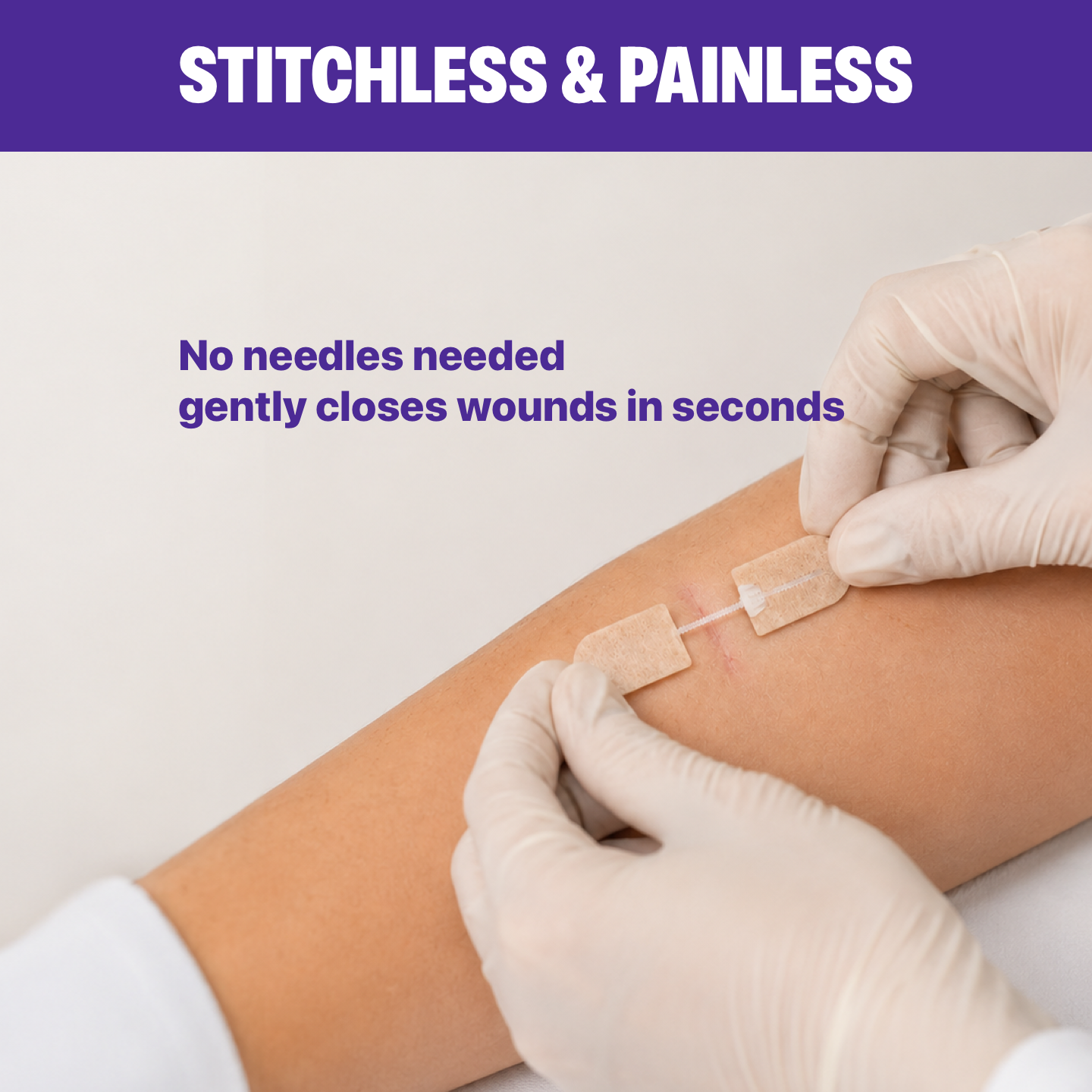 Wound Skin Closure Kit