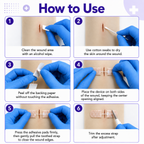 Wound Skin Closure Kit